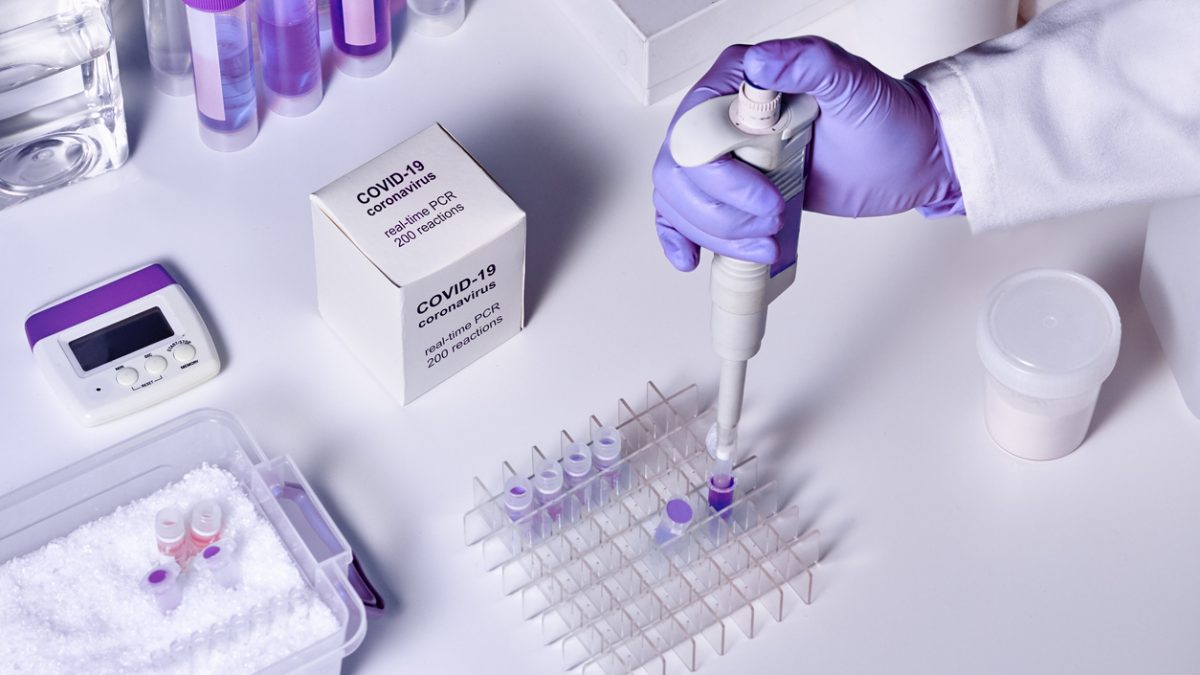 Coronavirus Test Kit Manufacturers in India